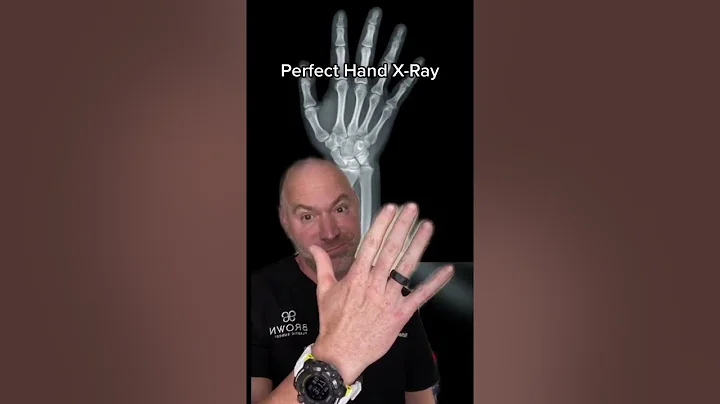 Worst Fireworks Injury Ever?! 😱 #shorts