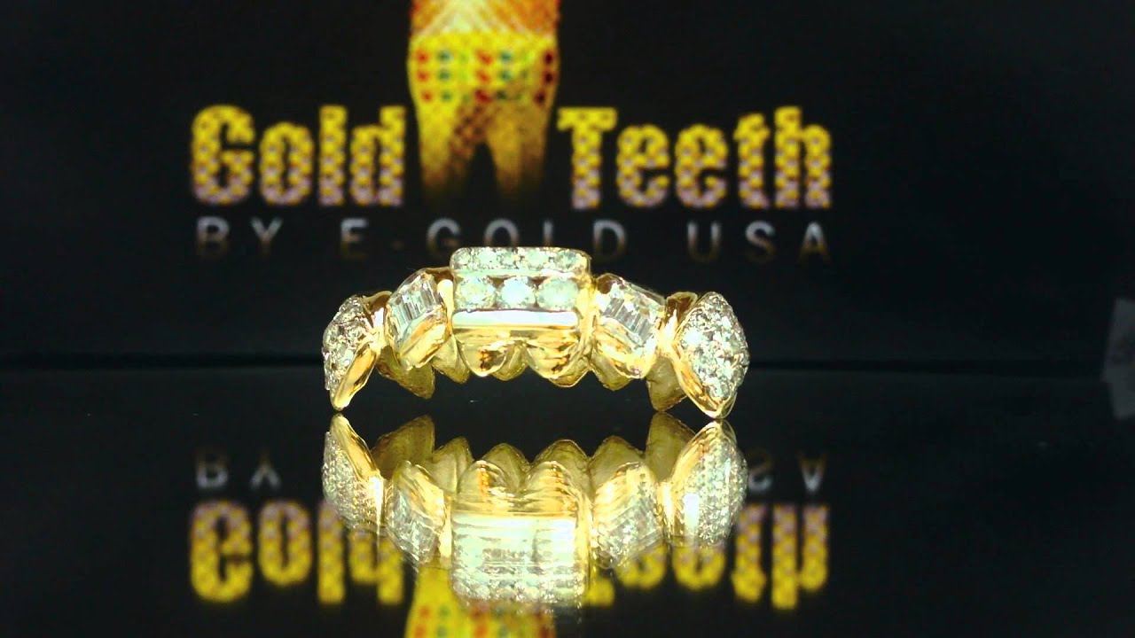 gold teeth by goldteethusa