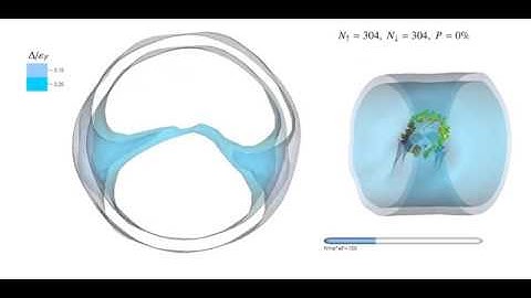 ASLDA: Solitonic cascade in unitary Fermi gas: spin-symmetric case P=0%, Movie 1, Visualization 4