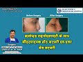 क्लोज़्ड राइनोप्लास्टी के साथ सौंदर्यात्मक होंठ सर्जरी एवं एलर बेस सर्जरी