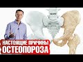 Причины остеопороза не в дефиците кальция📢Прием кальция опасен