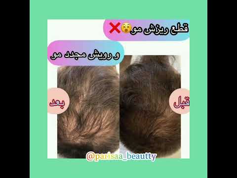 متخصص و مشاور پوست مو زیبایی