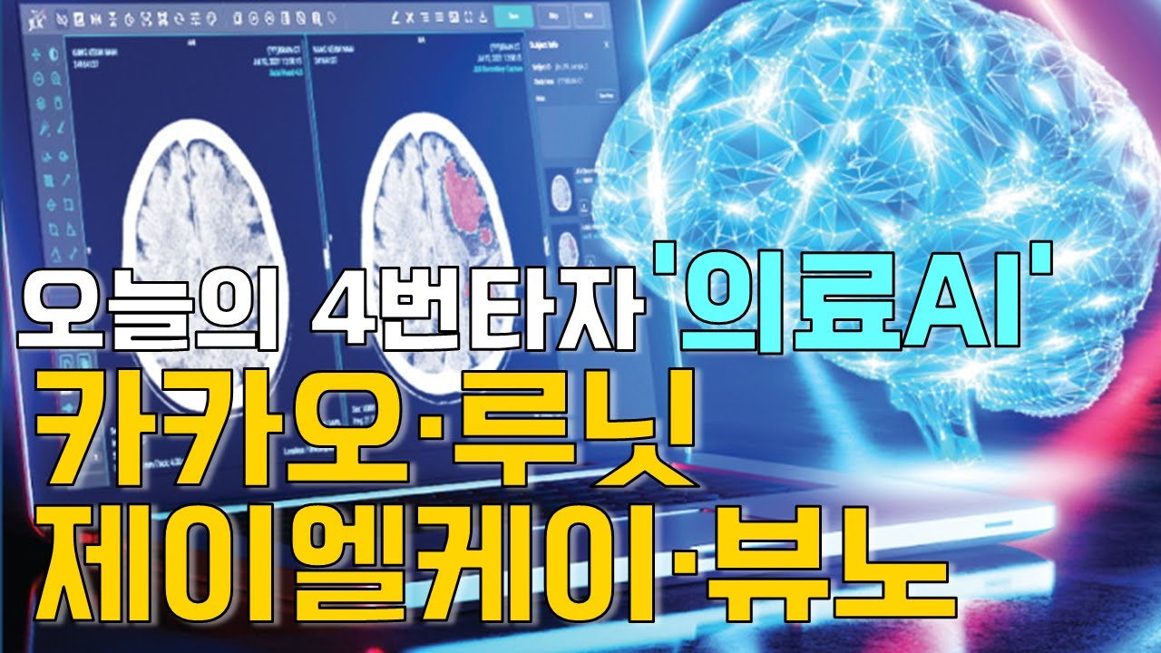 이재선의 만루홈런: 오늘의 4번타자 '의료AI'-카카오·루닛·제이엘케이·뷰노