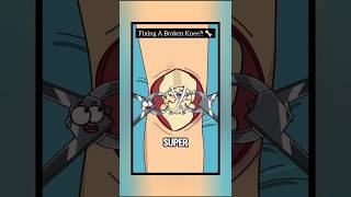 How Doctors Fix a Broken Knee: The Reality of Knee Fractures! 🦴 #shorts