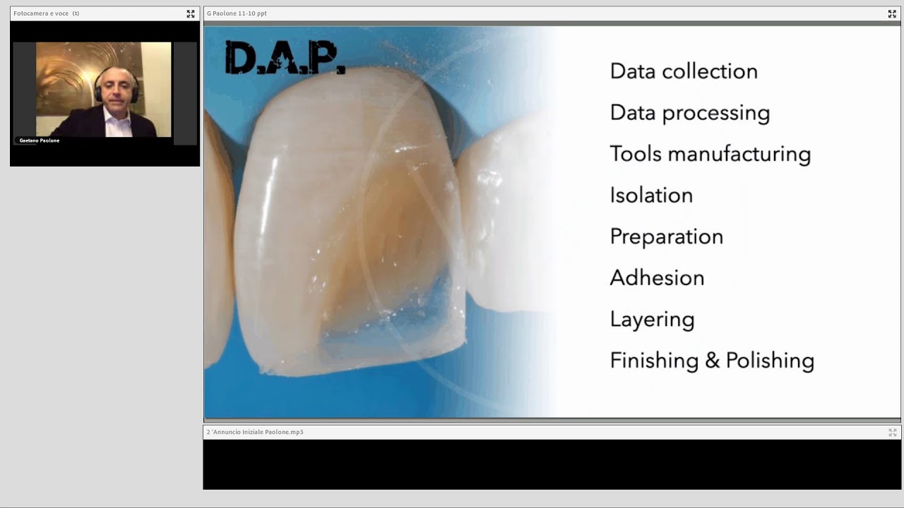 Le chiavi del successo nei restauri adesivi diretti anteriori
