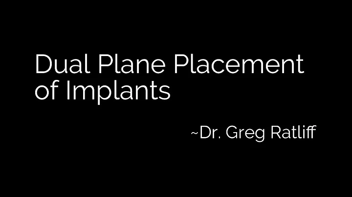 Dual Plane Placement of Implants