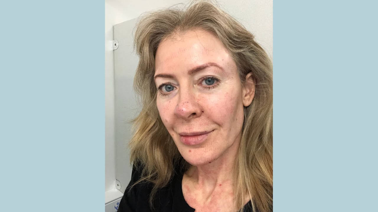 My stem-cell fat transfer procedure: 4, the post-procedure dip! | Alice Hart-Davis