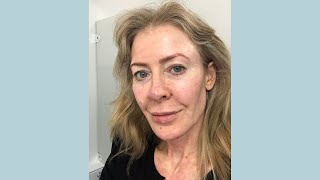 My stem-cell fat transfer procedure: 4, the post-procedure dip! | Alice Hart-Davis