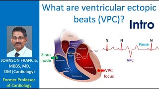 What are ventricular ectopic beats (VPC)? Intro