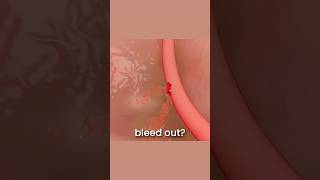 Is Nattokinase a Blood Thinner? #bloodviscosity #nattokinase