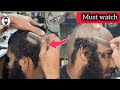 Head Shave 😠 Most Very Hard Dandruff Remove Head Shave Tutorial for Men's 😲