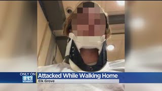 Students Beaten, Robbed By Teens Near Sheldon High School