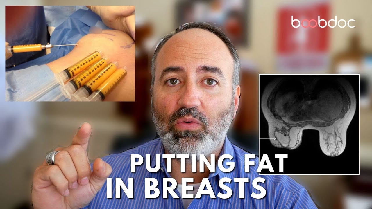 5 Reasons Not To Inject Fat Into Your Breasts - Breast Augmentation With Fat Grafting