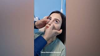 Burun Masajı Burun Əməliyyatı Sonrası Masaj Op. Dr. Huseyn Mammadov Plastıc Surgery
