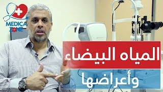 المياه البيضاء في العين وعلاجها وما هى اعراضها | MedicaZone