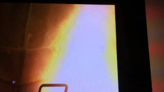 Call of duty : black ops  trofeo scimmia al barbecue screenshot 4
