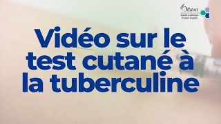 Vidéo sur le test cutané à la tuberculine