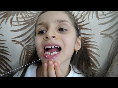 Video: Yavruların Dişleri Nasıl Değişir?