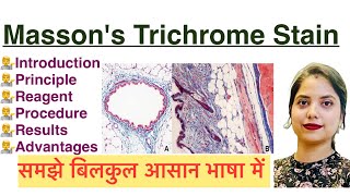 Mason’s Trichrome Stain in Hindi | Histology stain | MLT