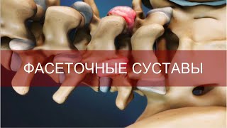 Фасеточные суставы