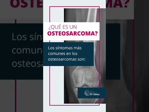 Video: ¿Cuál es la etiología del osteosarcoma?