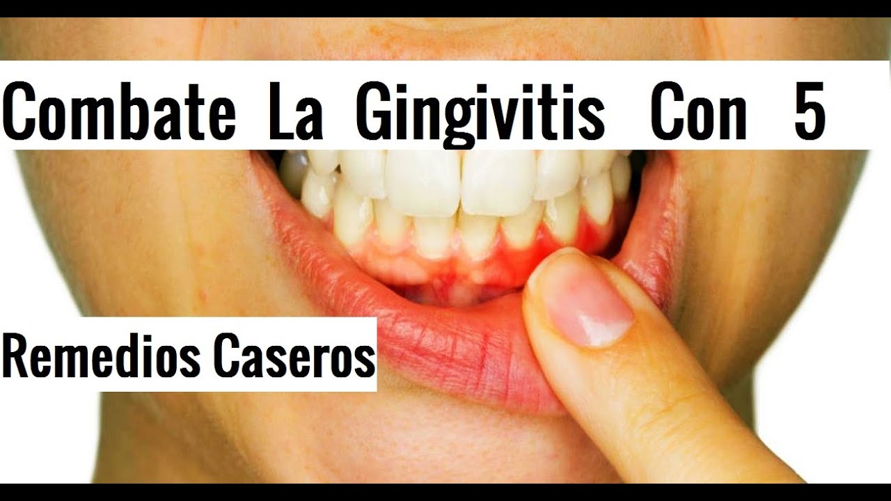 Combate la gingivitis con 5 remedios caseros YouTube