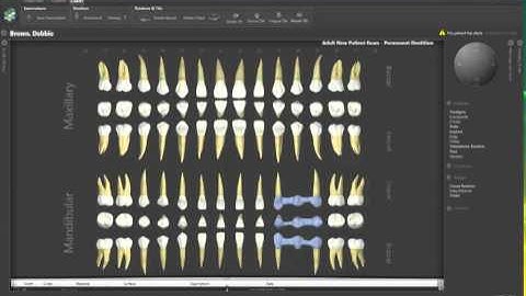 Odontogram Control in a sample UI