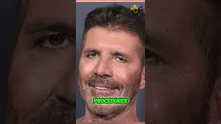 Shocking Transformation! 😲 Simon Cowell's Jaw-Dropping Look Change ✨