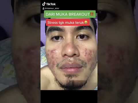 Video: Kemas Kini Penyertaan Bahagian Yang Besar Telah Bermula Dengan Sangat Kasar