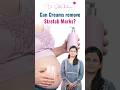 Pregnancy Stretch Marks Explained | Dr. Sahithi Balmuri Busts Myths & Shares Postpartum Care Tips
