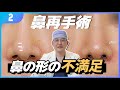 【鼻再手術 Part2】鼻再手術の理由は炎症ではなく形！