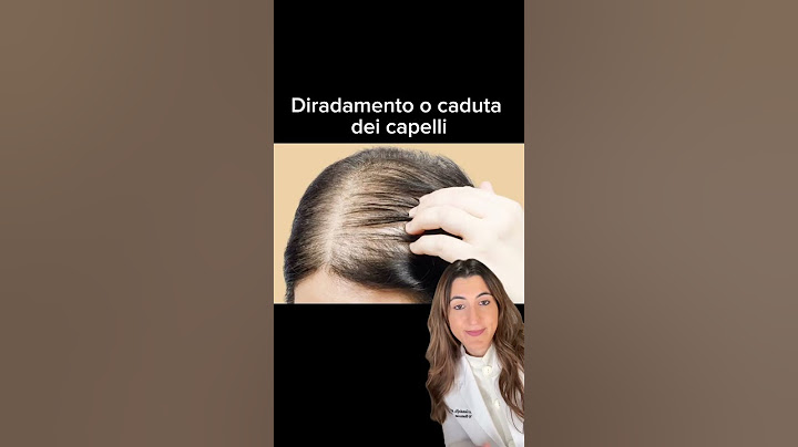 POV: La tua MALATTIA DELLA TIROIDE è di tipo Surrenale #shorts