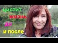 Цистит,как я с ним живу/удаление матки и яичников/ жизнь до и после...