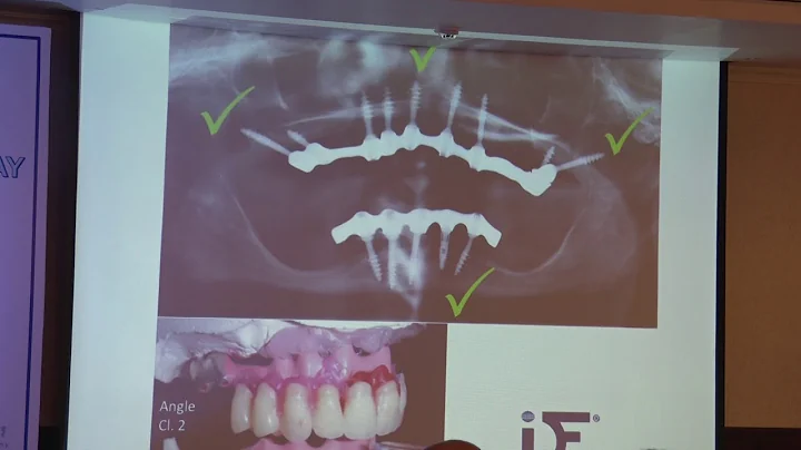 Disciplines of Strategic implantology by Dr. Ihde ...