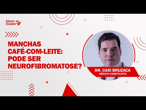 Manchas café-com-leite: pode