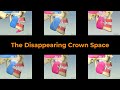 Disappearing crown space