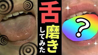 【虫歯がある人必見】現役栄養士が行う舌磨きを教えます