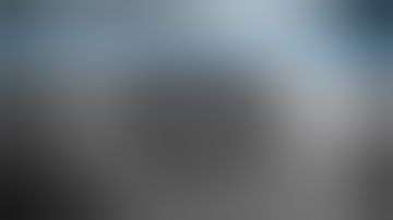 Phaco Annotated | VI. Cortex Removal