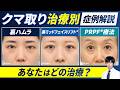 【保存版】どのクマ取り治療を受けるか迷われている方へ。症例を見ながら解説!裏ハムラ/裏ミッドフェイスリフト®︎/PRPF®︎療法【目の下のクマ】