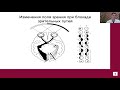 АДЕНОМА ГИПОФИЗА: КЛИНИЧЕСКИЕ И ПАТОЛОГОАНАТОМИЧЕСКИЕ ПРОБЛЕМЫ