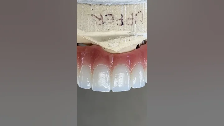 Stunning #Zirconia Arch #Implant #dental #teeth #smile #lsk121shorts #shortvideo #shorts