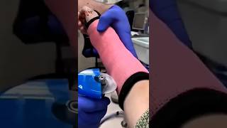 Plaster Cutter Skin Ko Kyun Nahi Katta🧐