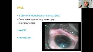 Glaucomatology 2020 ( Session #7 )  - Angle Closure Glaucoma screenshot 2