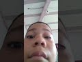 meu olho tá inchado