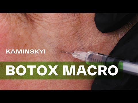 Videó: A Férj Nem Engedélyezi A Botox Injekcióját Stb