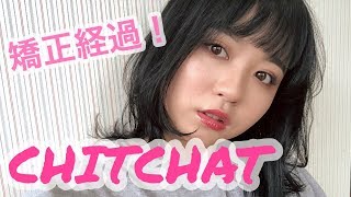 CHITCHAT!Vol.15!矯正の経過など！！