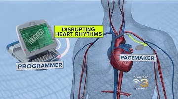 Researchers Say Implanted Medical Devices Vulnerable To Hackers