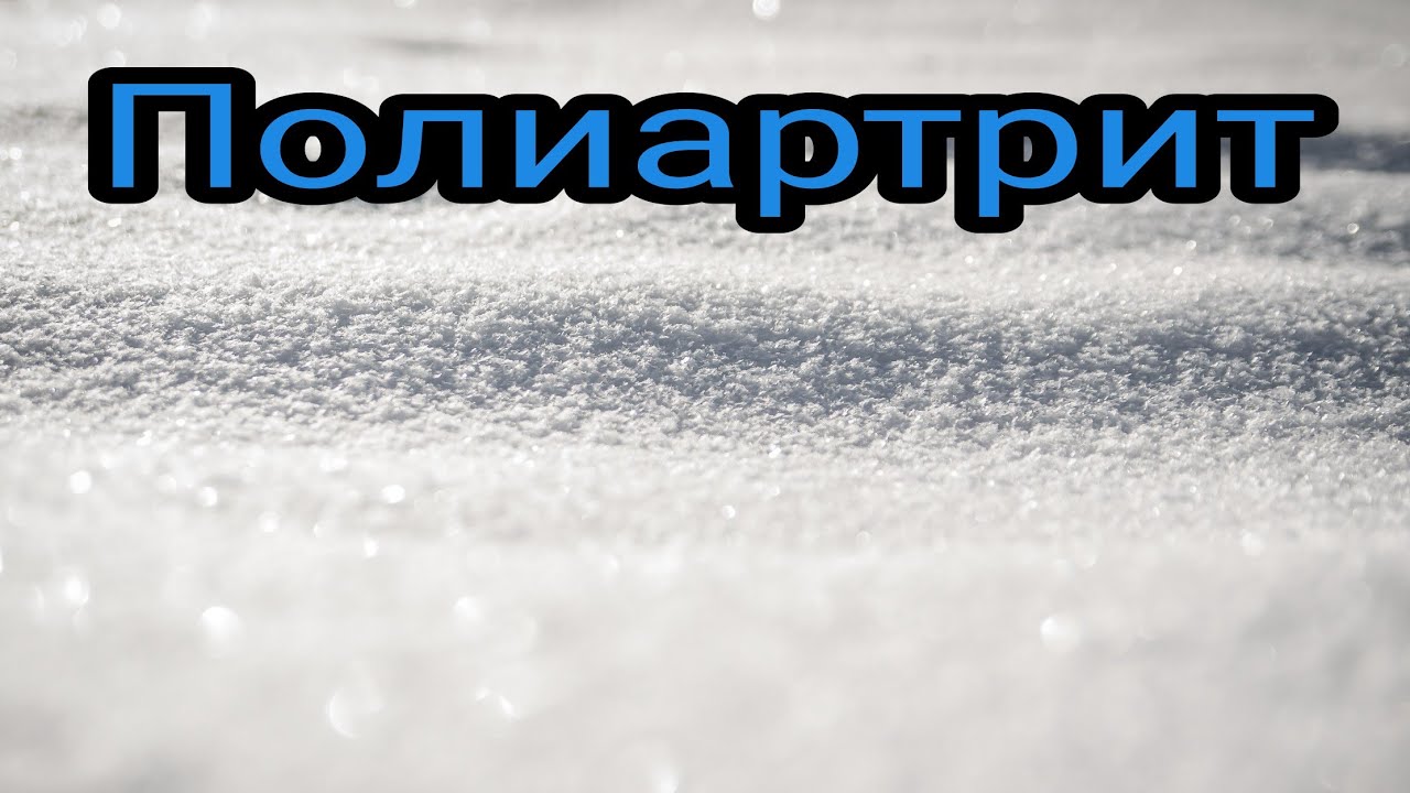 Полиартрит и его лечение. Народная медицина. Целитель. Травник. - YouTube