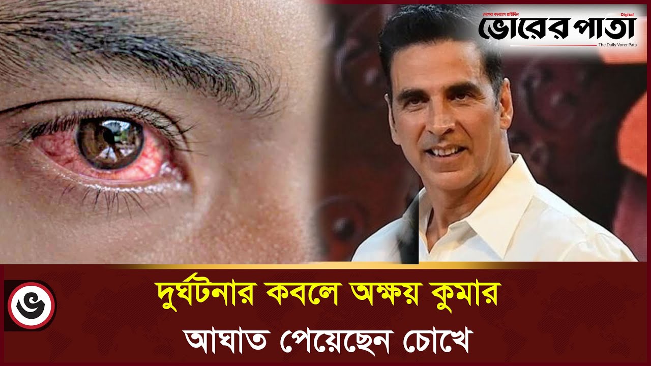 শ্যুটিং চলাকালীন বড়সড় বিপদে অক্ষয়! | Akshay Kumar | Eyes | Vorer ...