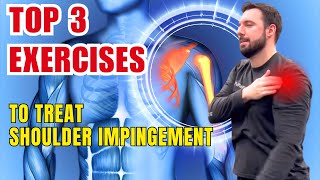 Top “3” Exercises to Treat Shoulder Impingement